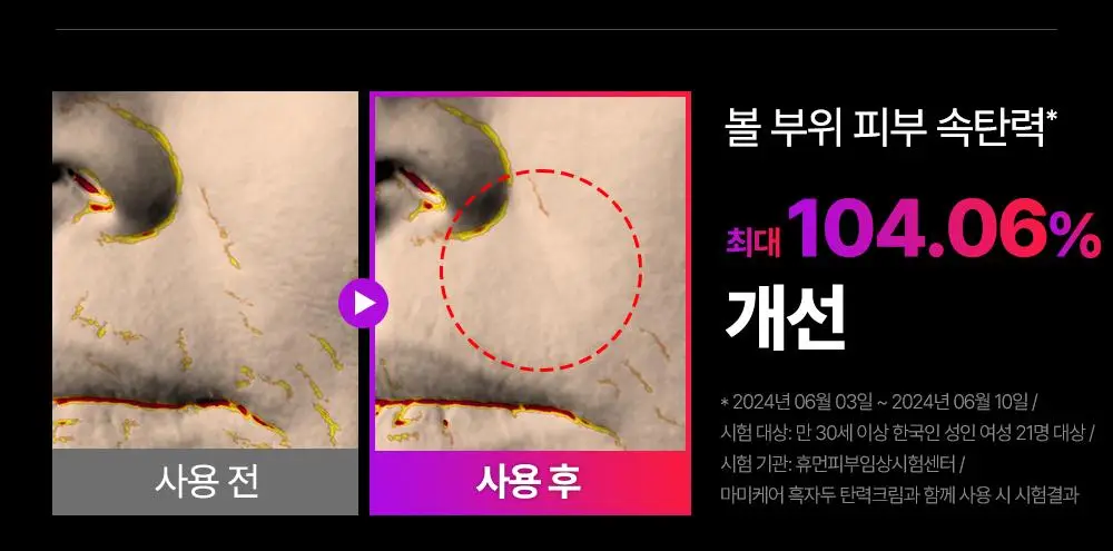 [7월 올영픽/이중턱개선] 마미케어 EMS 브이쎄라 (6 COLOR) 상세페이지 41